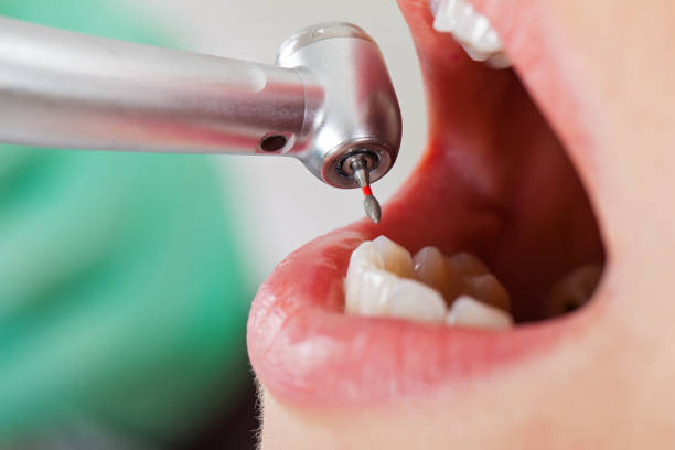 Best Pediatric Emergency Dentist in Swoyersville, PA